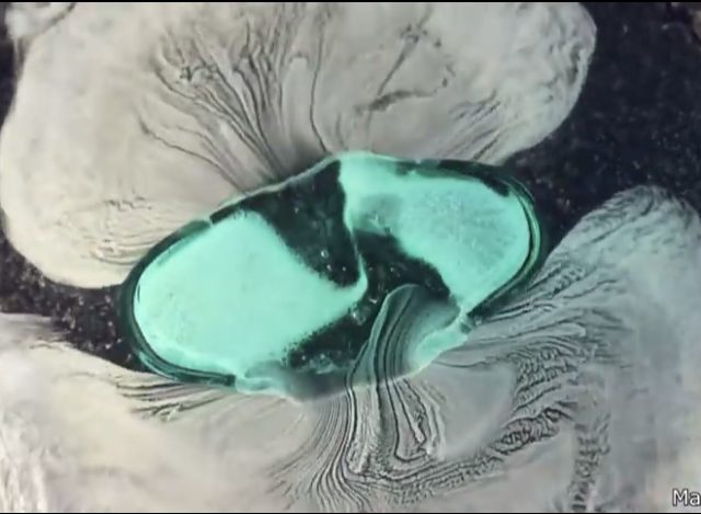 What Happens When You Swallow A Pill? [VIDEO]