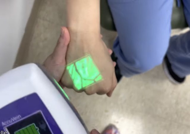 Vein Finders Are Real. And Very Creepy.